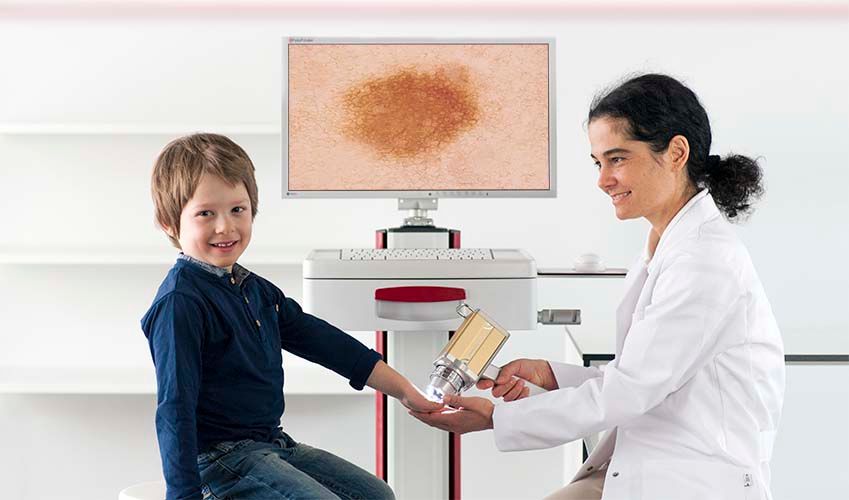 Dermatóloga examinando un lunar con el dermatoscopio digital FotoFinder; la imagen ampliada se ve en el monitor del equipo
